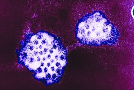 诺沃克病毒传染性强，将导致疯狂呕吐腹泻发烧